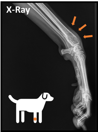 Osteosarcoma X-Ray
